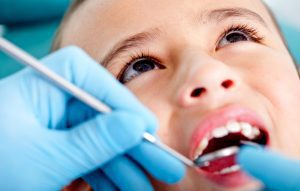 Dr. Israel Ortiz 17 Como se curan las caries en dientes de leche