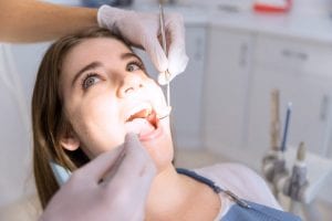 tipos empastes dentalbell