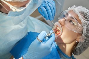 Respondemos a las preguntas más frecuentes sobre cirugía bucal
