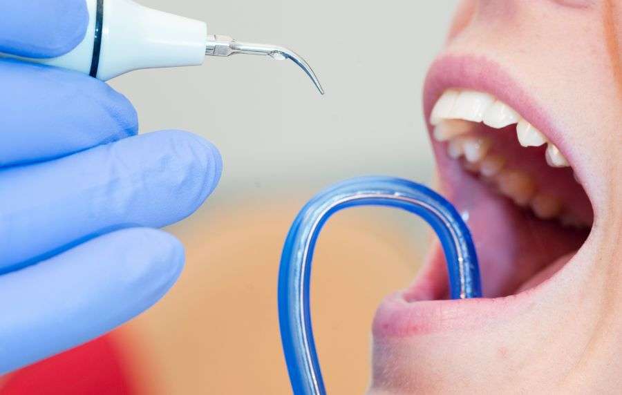 Blog 9 en que consiste una limpieza dental
