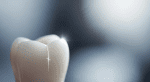 Diferencias entre fisura y fractura dental: ¿qué debes saber? 1 Fisura o Fractura Dental