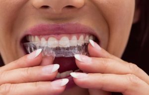 Dra. Vanessa Bocanegra 13 dientes se mueven